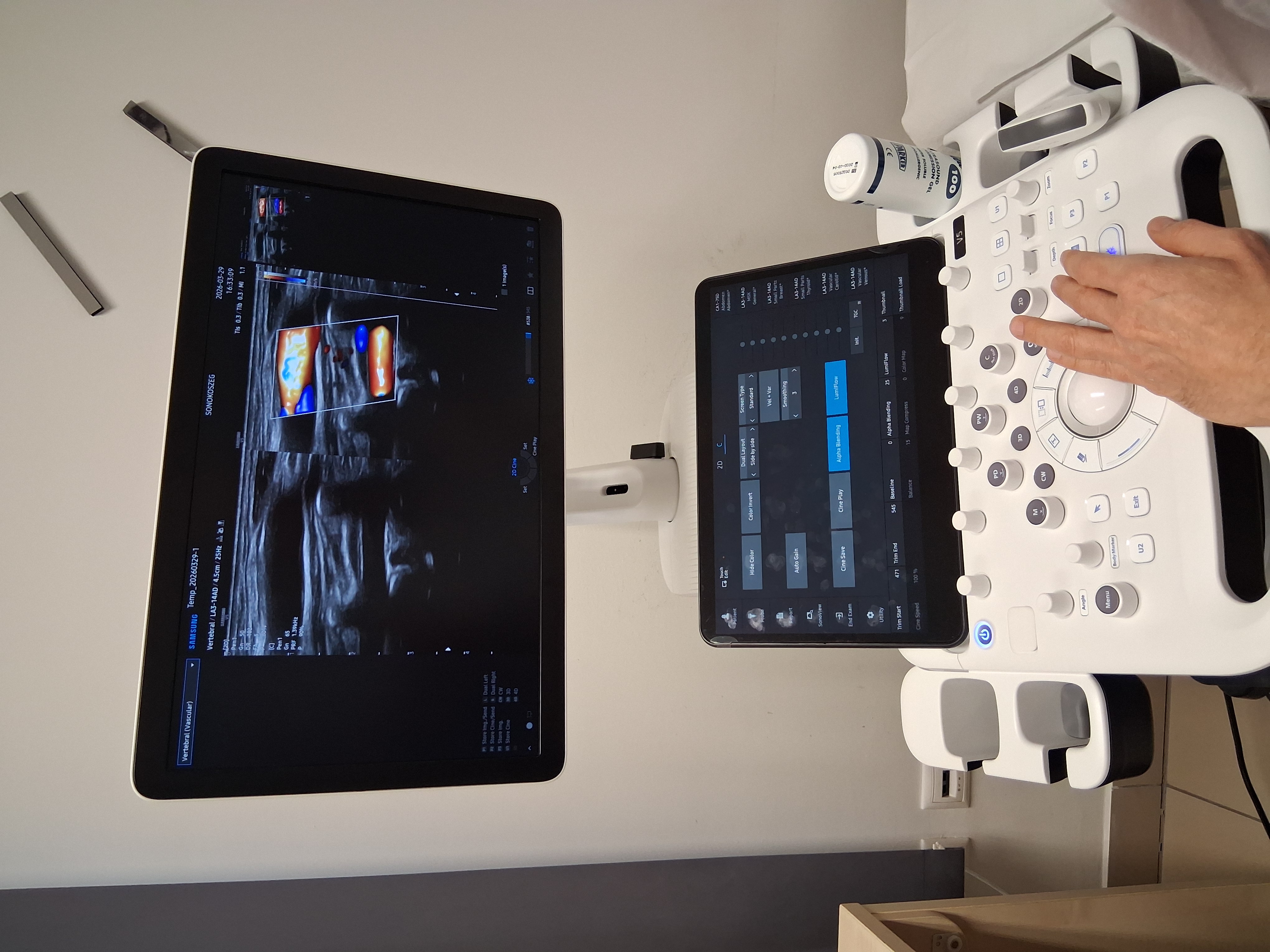 Ultrahang vizsgálat technológiája